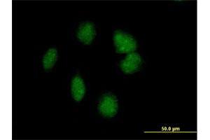 Immunofluorescence of purified MaxPab antibody to POMC on HeLa cell.