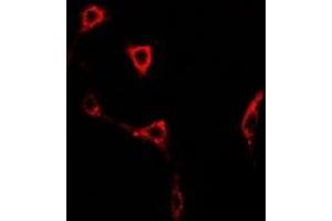 Immunofluorescent analysis of GLUR6 staining in U2OS cells. (GRIK2 anticorps)