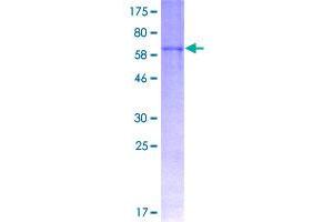 Fibromodulin (FMOD) (AA 1-376) protein (GST tag)