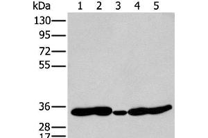 Western blot analysis of 231 Mouse heart tissue Human fetal brain tissue Jurkat and Hepg2 cell using HOXC11 Polyclonal Antibody at dilution of 1:250 (HOXC11 anticorps)