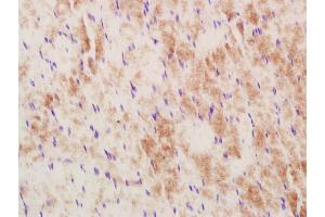 Paraformaldehyde-fixed, paraffin embedded Rat skeletal muscle; Antigen retrieval by boiling in sodium citrate buffer (pH6.