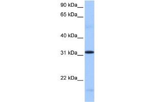 WB Suggested Anti-FUSIP1 Antibody Titration:  0. (SRSF10 anticorps  (C-Term))