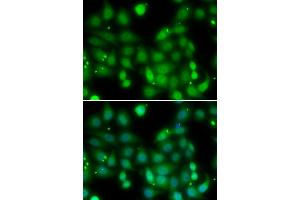 Immunofluorescence analysis of MCF-7 cells using RORA antibody (ABIN5974193). (RORA anticorps)