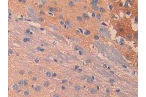 DAB staining on IHC-P; Samples: Mouse Cerebrum Tissue (IL13 Receptor alpha 1 anticorps  (AA 28-171))