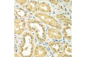 Immunohistochemistry of paraffin-embedded human kidney using RPS6KL1 antibody (ABIN5975299) at dilution of 1/100 (40x lens). (RPS6KL1 anticorps)