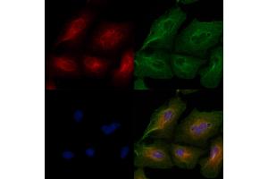 ABIN6259051 and ABIN6274992 staining  cells by IF/ICC.