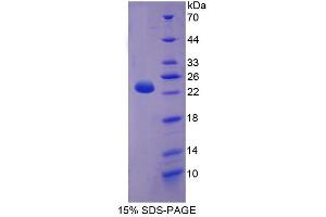 Image no. 1 for Carnitine Palmitoyltransferase 1B (Muscle) (CPT1B) (AA 602-772) protein (His tag) (ABIN4990400)