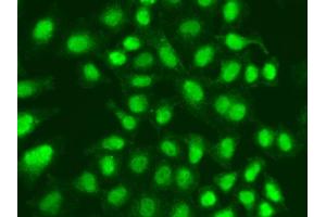 Immunofluorescence analysis of A549 cell using APTX antibody. (Aprataxin anticorps)