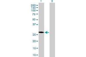 Western Blot analysis of HSD17B3 expression in transfected 293T cell line by HSD17B3 MaxPab polyclonal antibody. (HSD17B3 anticorps  (AA 1-310))