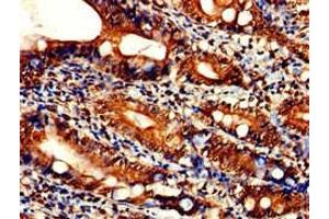 Immunohistochemistry of paraffin-embedded human small intestine tissue using ABIN7169201 at dilution of 1:100 (TLK2 anticorps  (AA 23-234))