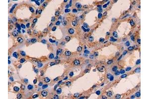 DAB staining on IHC-P; Samples: Mouse Kidney Tissue (ETFA anticorps  (AA 34-295))