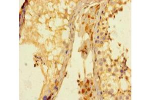 Immunohistochemistry of paraffin-embedded human testis tissue using ABIN7158695 at dilution of 1:100 (KDM4A anticorps  (AA 127-364))