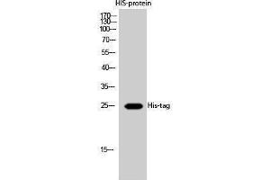 Western Blotting (WB) image for anti-His Tag antibody (ABIN3180426) (His Tag anticorps)
