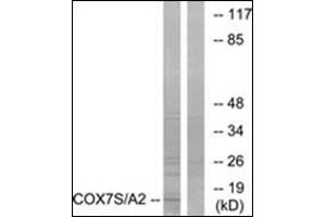 Western blot analysis of extracts from rat heart cells, using COX7S/A2 Antibody. (COX7A2 anticorps  (N-Term))