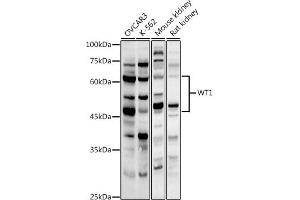 Western blot analysis of extracts of various cell lines, using WT1 antibody (ABIN3021697, ABIN3021698, ABIN3021699, ABIN1513692 and ABIN6215537) at 1:1000 dilution. (WT1 anticorps  (AA 1-302))