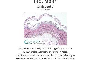 Image no. 1 for anti-Malate Dehydrogenase 1, NAD (Soluble) (MDH1) antibody (ABIN1736856)