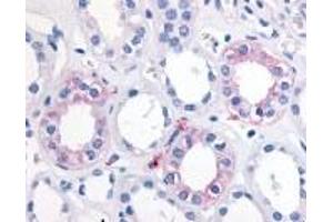 Immunohistochemistry (IHC) image for anti-Epoxide Hydrolase 2, Cytoplasmic (EPHX2) (Internal Region) antibody (ABIN2469511) (EPHX2 anticorps  (Internal Region))