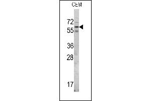 Western blot analysis of RIOK2 Center (ABIN390991 and ABIN2841174) in CEM cell line lysates (35 μg/lane). (RIOK2 anticorps  (AA 270-299))