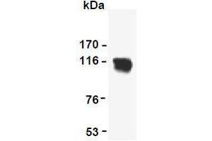 Western Blotting (WB) image for anti-Reversion-Inducing-Cysteine-Rich Protein with Kazal Motifs (RECK) (AA 621-832) antibody (ABIN1108847) (RECK anticorps  (AA 621-832))