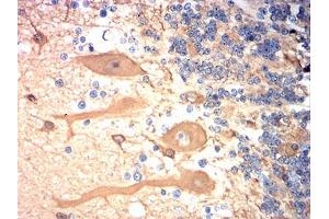 Immunohistochemical analysis of paraffin-embedded cerebellum tissues using TUBB3 mouse mAb with DAB staining. (TUBB3 anticorps)