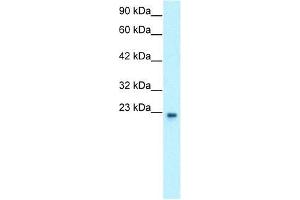Human HepG2; WB Suggested Anti-GTF2F2 Antibody Titration: 0. (GTF2F2 anticorps  (Middle Region))