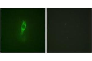 Immunofluorescence analysis of NIH-3T3 cells, using ETK (Phospho-Tyr40) Antibody. (BMX anticorps  (pTyr40))