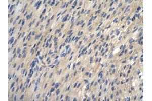 Rabbit Anti-TRIantibody        Paraffin Embedded Tissue:  Human Heart cell   Cellular Data:  Epithelial cells of renal tubule  Antibody Concentration:   4. (TRIP13 anticorps  (N-Term))