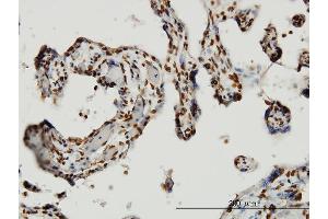 Immunoperoxidase of monoclonal antibody to HMGB1 on formalin-fixed paraffin-embedded human placenta. (HMGB1 anticorps  (AA 1-90))