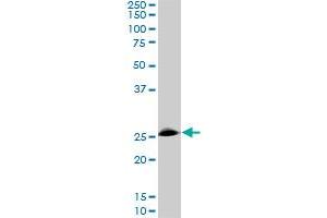 Western Blotting (WB) image for anti-Ring Finger Protein 141 (RNF141) (AA 141-230) antibody (ABIN599236) (RNF141 anticorps  (AA 141-230))