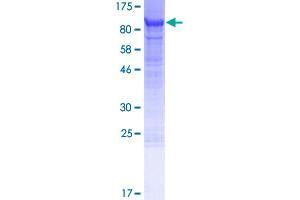 Leucine Rich Repeat Neuronal 1 (LRRN1) (AA 1-716) protein (GST tag)