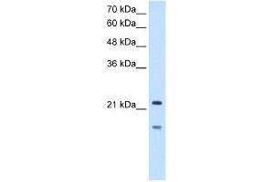WB Suggested Anti-MMP7 Antibody Titration:  2. (MMP7 anticorps  (C-Term))