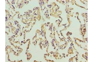 Immunohistochemistry of paraffin-embedded human lung tissue using ABIN7164085 at dilution of 1:100 (PRDM14 anticorps  (AA 301-571))