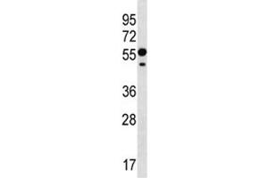RNF8 antibody western blot analysis in CEM lysate.