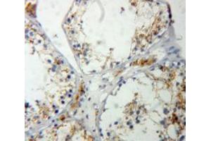 IHC-P analysis of Testis tissue, with DAB staining. (RASA1 anticorps  (AA 403-596))