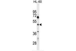 CEPT1 Antibody (N-term) western blot analysis in HL60 cell line lysates (35µg/lane).