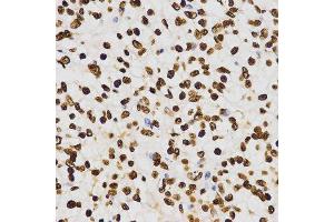Immunohistochemistry (IHC) image for anti-Histone H3 (H3) (H3K27me) antibody (ABIN3023266)