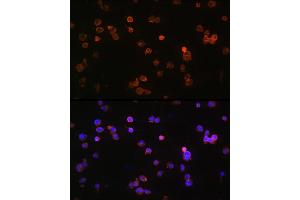 Immunofluorescence analysis of Jurkat cells using P2RX5 Rabbit pAb (ABIN6132450, ABIN6145117, ABIN6145118 and ABIN6215403) at dilution of 1:100 (40x lens). (P2RX5 anticorps  (AA 341-422))
