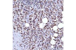 IHC analysis of RAB3GAP1 using anti-RAB3GAP1 antibody (ABIN7599702). (RAB3GAP1 anticorps  (AA 109-810))
