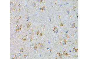 Immunohistochemistry of paraffin-embedded Mouse brain using KISS1R Polyclonal Antibody at dilution of 1:100 (40x lens). (KISS1R anticorps)