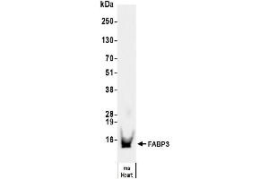 anti-Fatty Acid Binding Protein 3, Muscle and Heart (FABP3) antibody