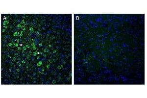 Expression of ADAM10 in mouse parietal cortex. (ADAM10 anticorps  (Extracellular, N-Term))