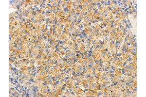 ABIN6258663 and ABIN6274813 at 1/100 staining Rat ovarian tissue by IHC-P.