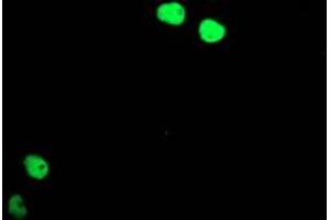 Image no. 3 for anti-T-Cell Acute Lymphocytic Leukemia 1 (TAL1) antibody (ABIN1501289)