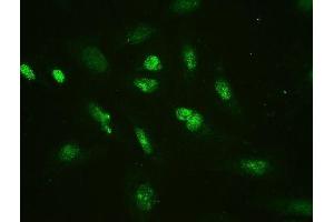 IF analysis of HMGB2 using anti-HMGB2 antibody (ABIN4886620). (HMGB2 anticorps  (N-Term))
