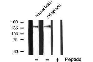 Western blot analysis of VEGFR1 expression in mouse brain and rat spleen tissue lysates,The lane on the right is treated with the antigen-specific peptide. (FLT1 anticorps)