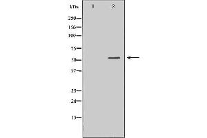Western blot analysis of extracts of Raji, using HCK antibody.