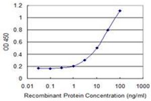 Detection limit for recombinant GST tagged DCK is 0.