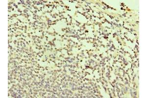 Immunohistochemistry of paraffin-embedded human small intestine tissue using ABIN7171996 at dilution of 1:100