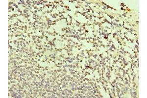Immunohistochemistry of paraffin-embedded human small intestine tissue using ABIN7171996 at dilution of 1:100 (TXNDC11 anticorps  (AA 656-985))