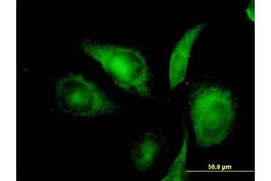 Immunofluorescence of monoclonal antibody to NIFUN on HeLa cell. (ISCU anticorps  (AA 26-167))